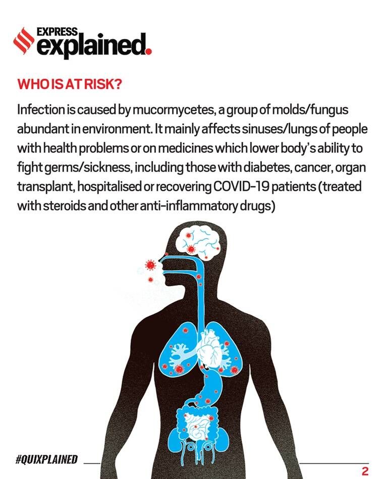 Fungo negro, Mucormicose, O que é fungo negro, Qual mucormicose, Casos de fungo negro, Sintomas de fungo negro, Tratamento de fungo negro, Indian Express
