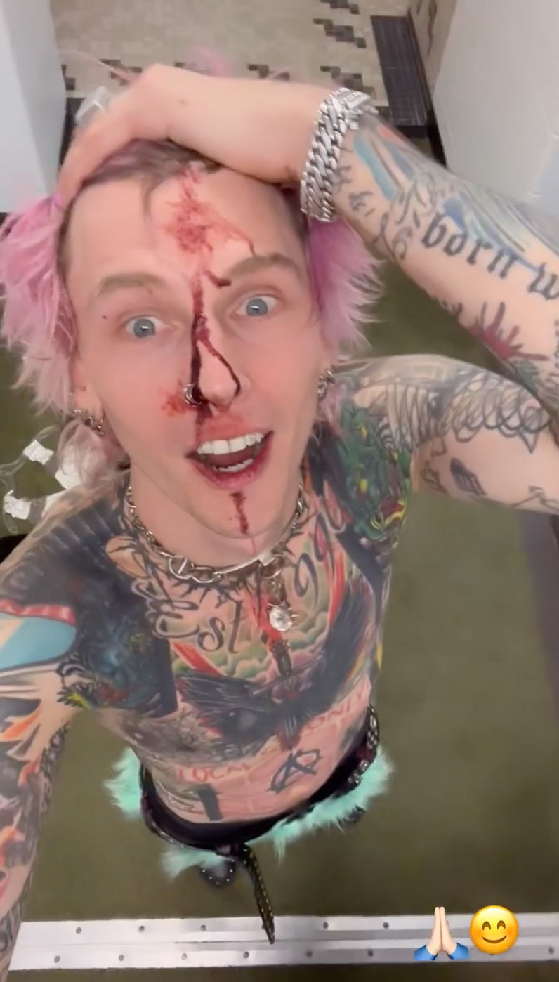 Machine Gun Kelly mostra rosto sangrento após show F-king Insane Cleveland