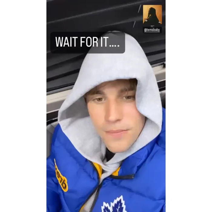   Justin Bieber mostra mobilidade em seu rosto após diagnóstico de síndrome de Ramsay Hunt 3