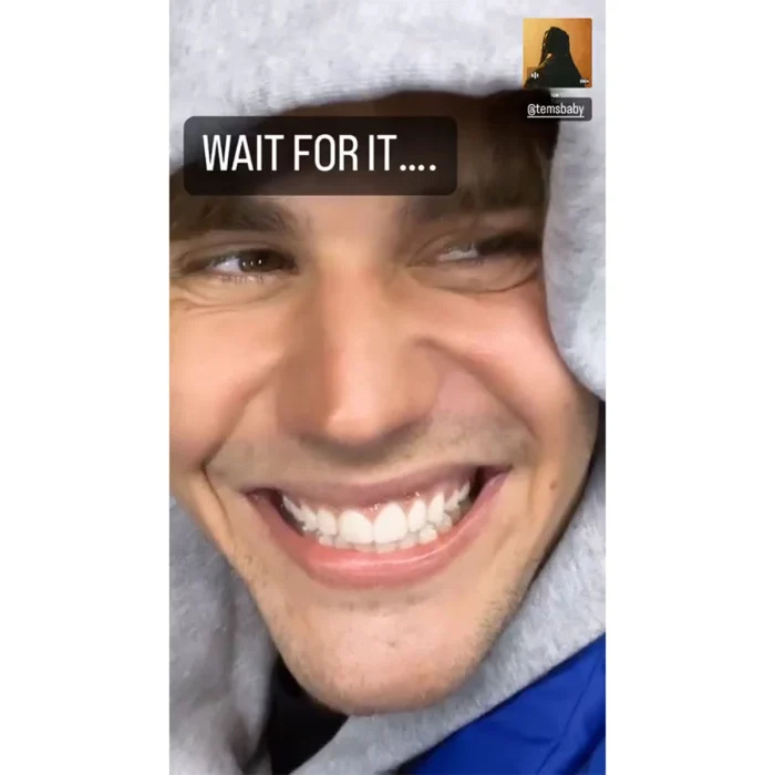   Justin Bieber mostra mobilidade em seu rosto após diagnóstico de síndrome de Ramsay Hunt 2