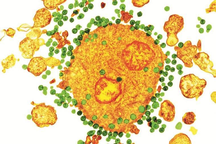 HIV, cura do HIV, AIDS, doença de AIDS, British Scientist HIV cure, novo tratamento experimental, erradicação do HIV, medicamentos para HIV, notícias de saúde, notícias do mundo