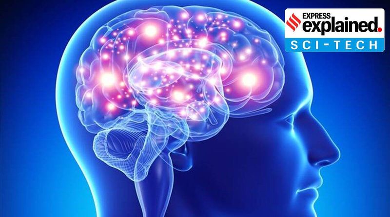 Explicado: O que é estimulação cerebral profunda?