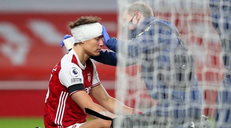 David Luiz e Raul Jimenez, fratura de crânio de Raul Jimenez, lesão de David Luiz, atualização de lesão de Raul Jimenez, lesão na cabeça de Raul Jimenez, vídeo de lesão de Raul Jimenez, recuperação de Raul Jimenez