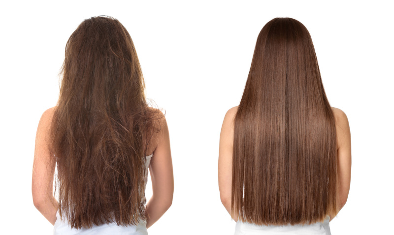 Antes-Depois-Tratamento de Cabelo-Stock-Photo