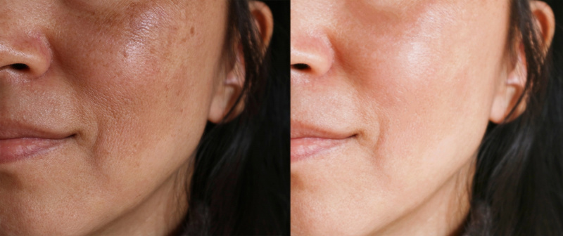 amazon-goodal-vitamina-c-serum