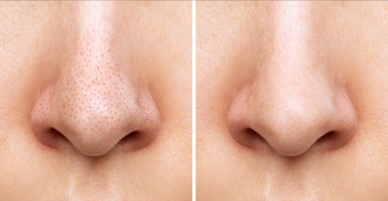  bioderma-pore-refining-cream