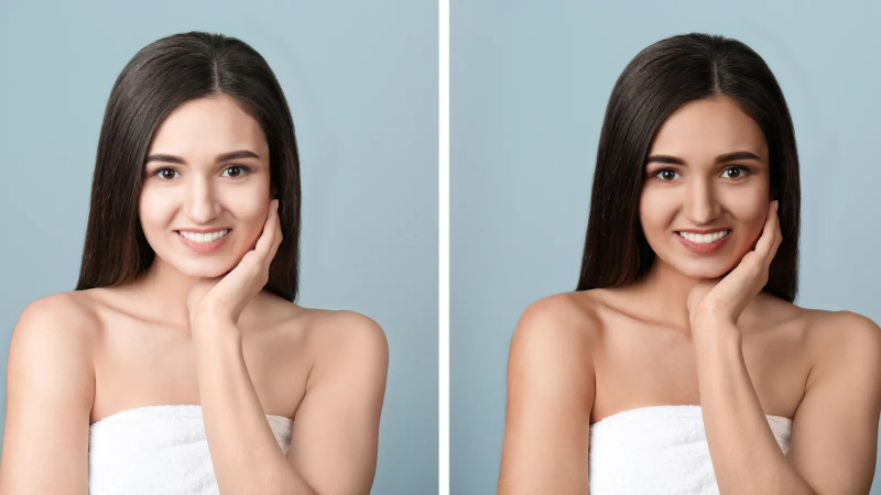   antes e depois do bronzeado