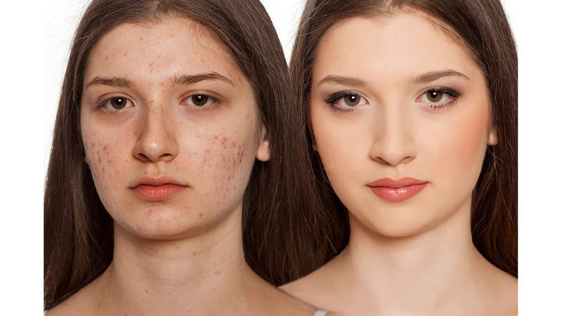 Os compradores estão chamando este soro de retinol de US $ 20 como um 'grande divisor de águas' para sua pele