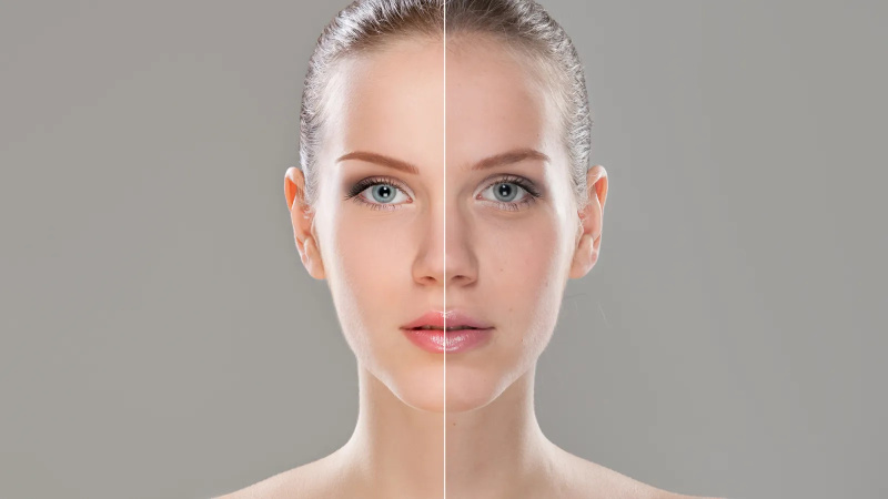 cuidados com a pele antes e depois