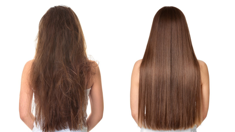 Antes-Depois-Tratamento de Cabelo-Stock-Photo