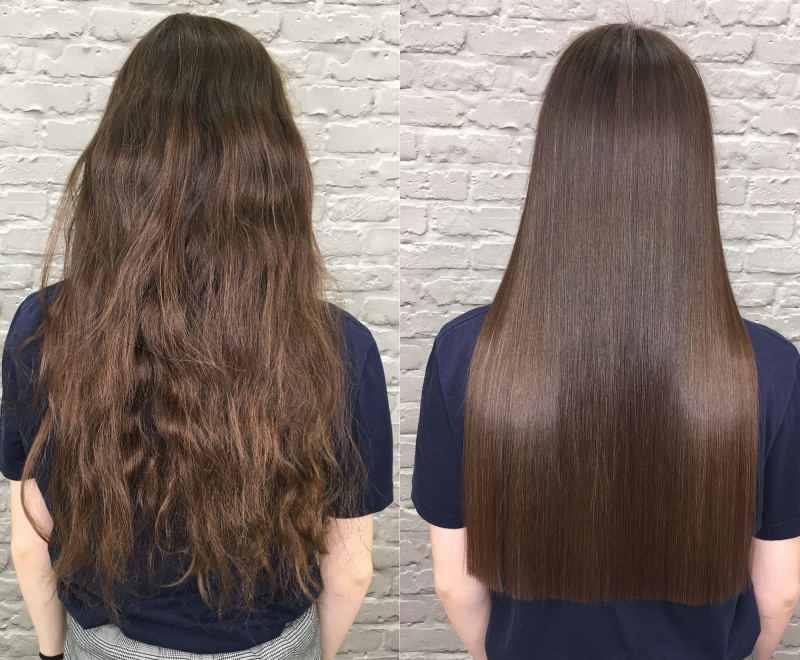   Antes-Depois-Crescimento-Cabelo-Estoque-Foto