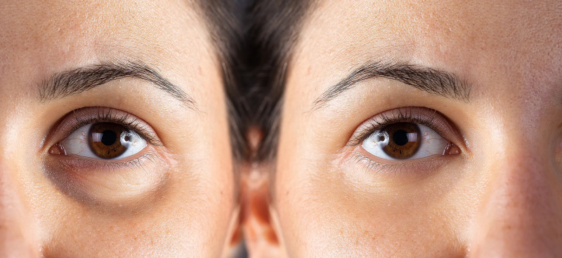 amazon-oito-santos-creme para os olhos